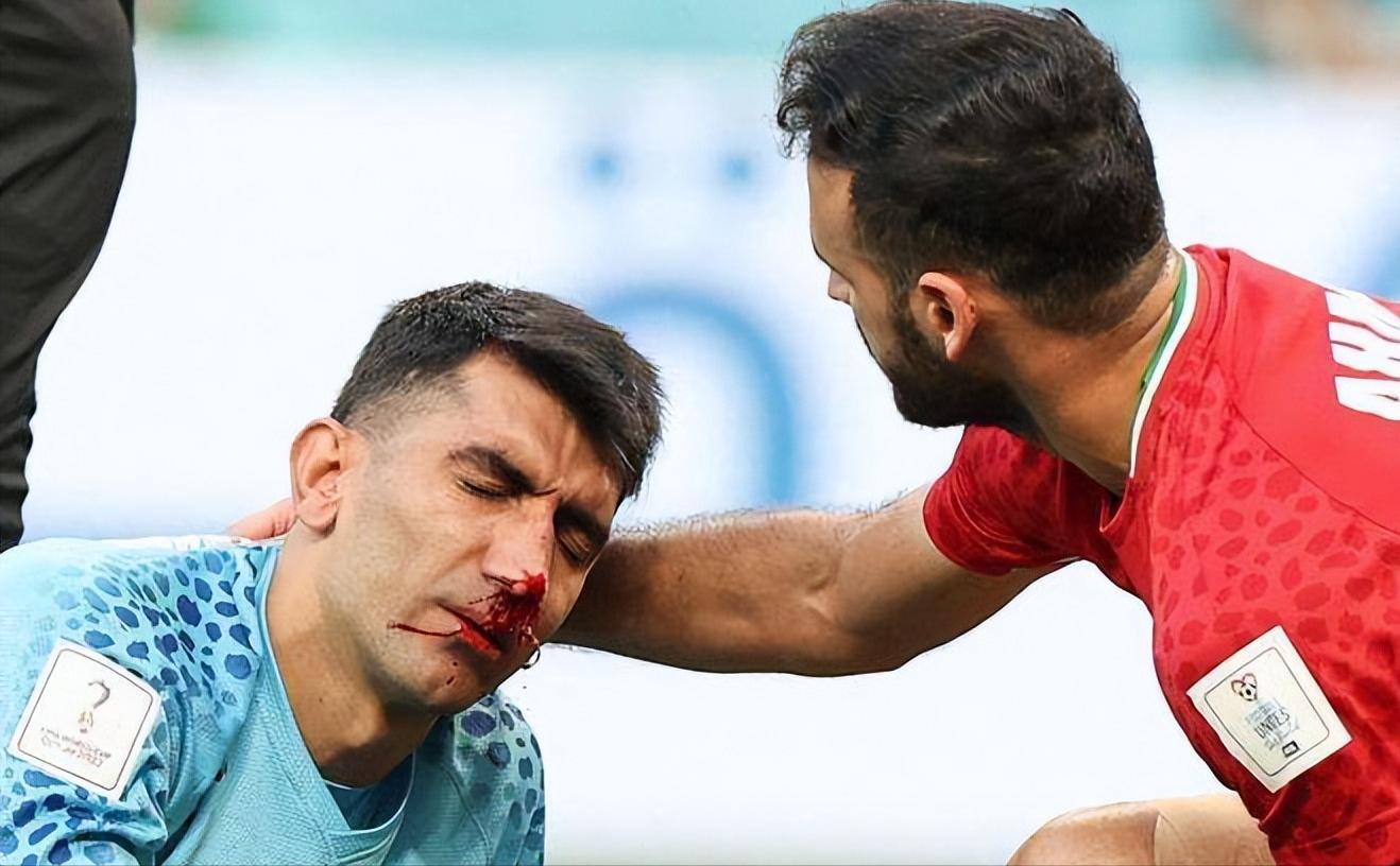 疼疼疼！世界杯球员相撞鼻骨骨折被迫离场医生：头球争抢需谨慎