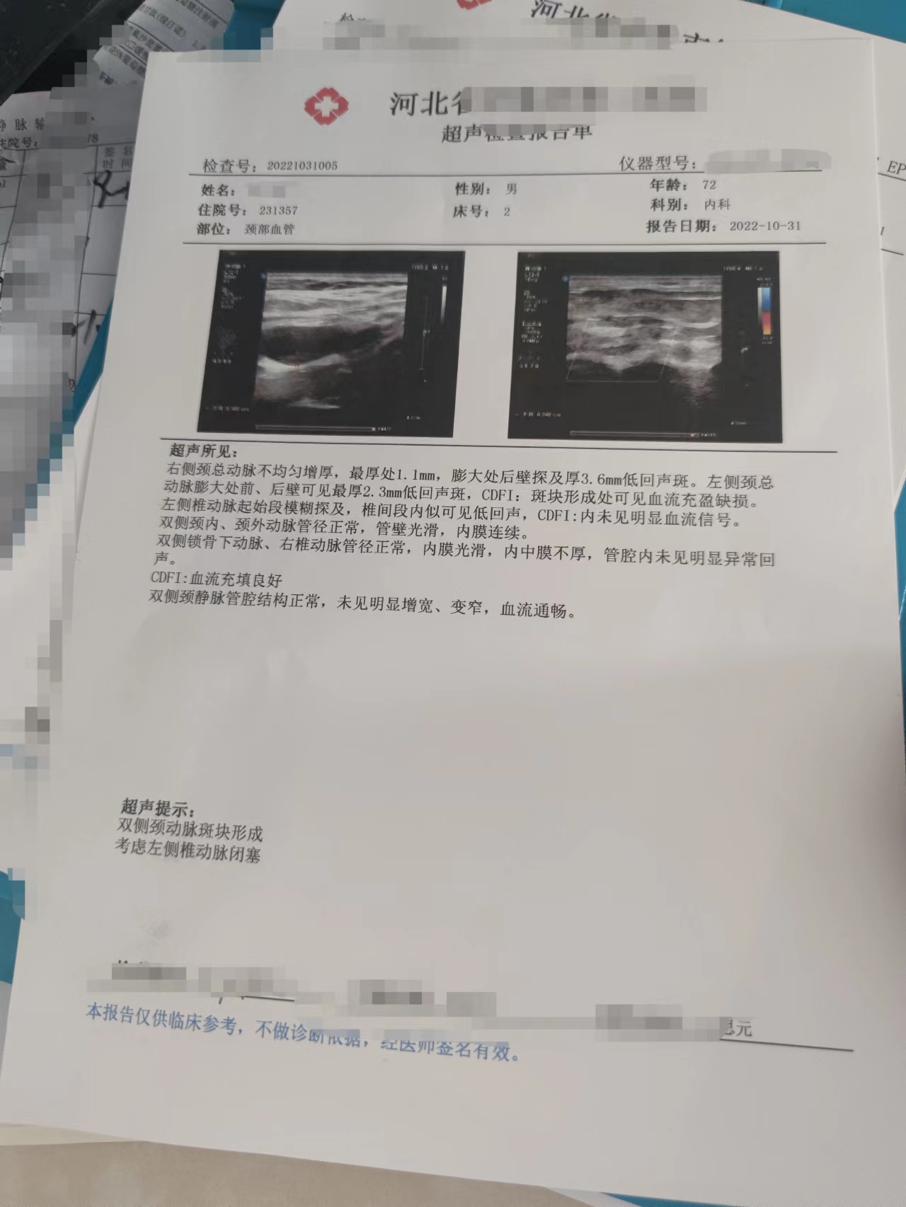 一例头痛头晕患者个案护理,患者出现头晕一侧眼睛看不清