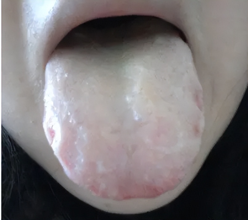 人体脾虚怎么调养,脾胃湿热和脾虚吃什么中成药