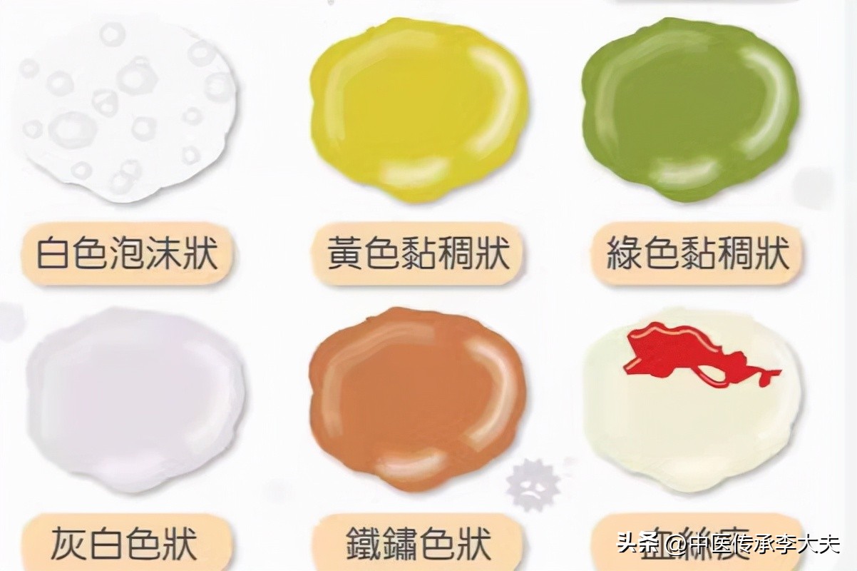 黄痰痰多止咳化痰中药,黄痰浓稠干咳用什么中药