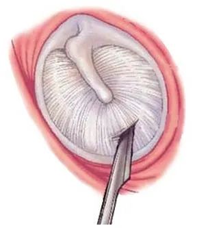 爱耳小知识,爱耳日科普