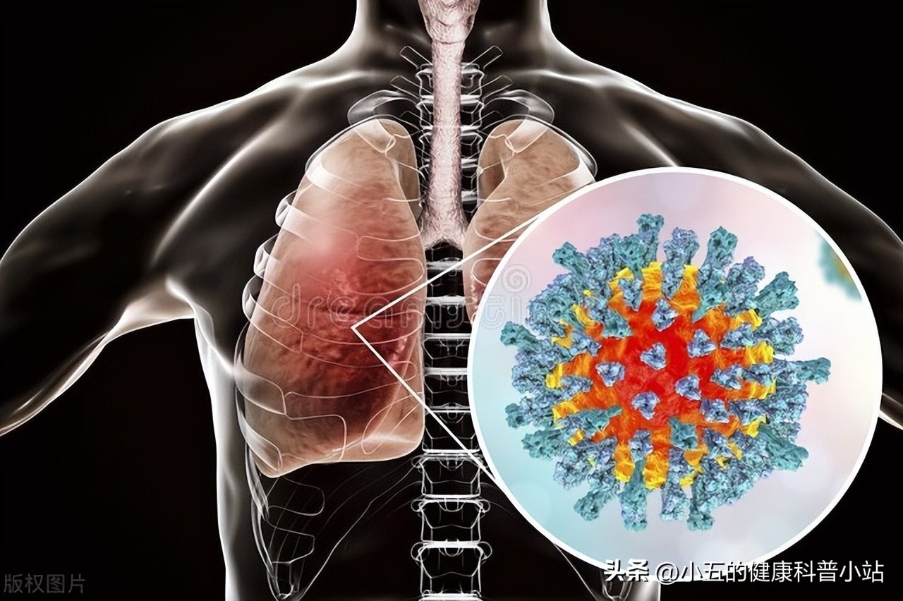 阿奇霉素对支原体感染有好处吗,支原体感染阿奇霉素作用和功效