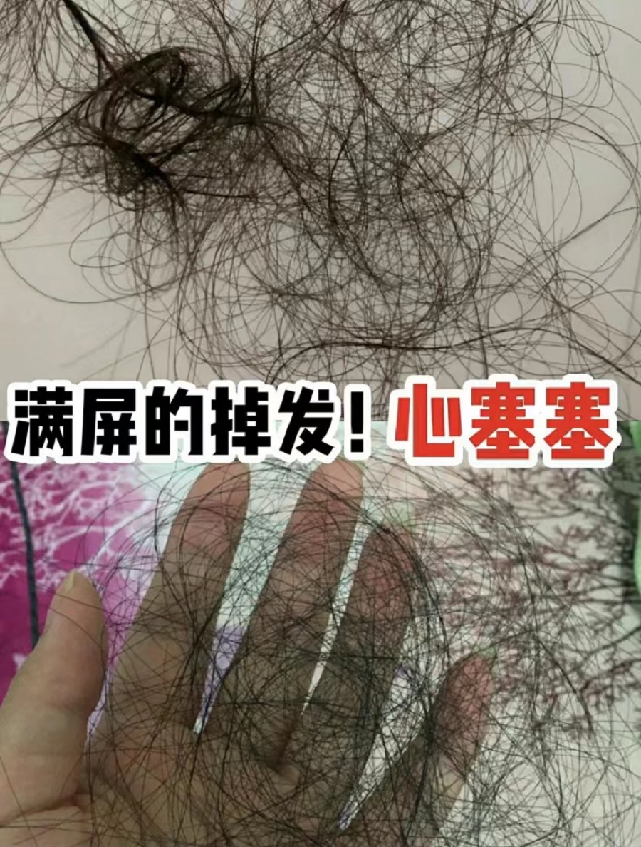 十大防脱发控油洗发水排行榜,防脱发女士用的哪一款洗发水好