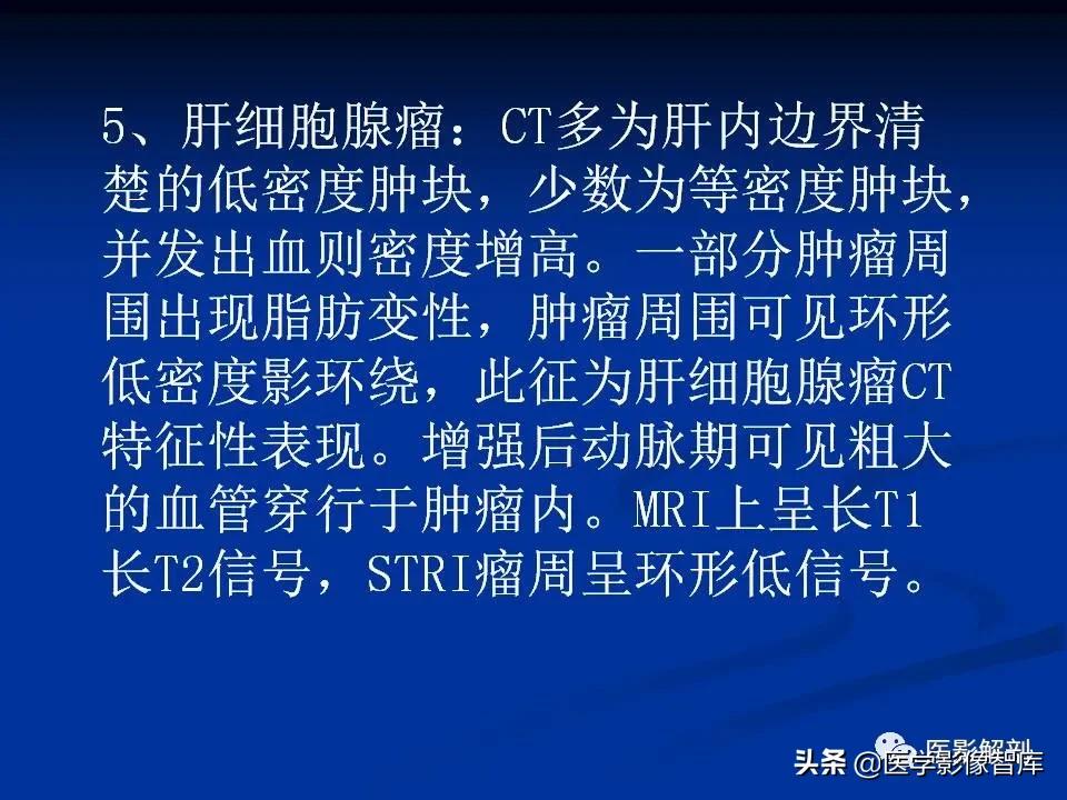 肝炎性假瘤鉴别诊断,肝炎性假瘤影像学表现