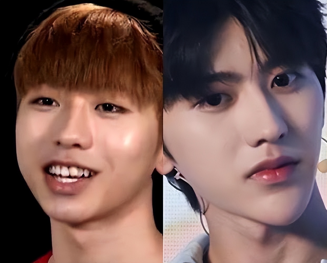 过度医美失败的男明星照片,医美过度的男明星有多吓人