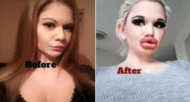 全网最厚嘴唇女网红,整容很多次网红厚嘴唇