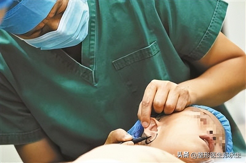 为什么会导致小耳畸形,大小耳畸形有遗传吗