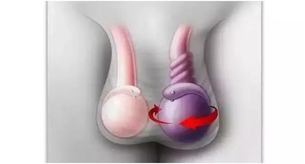 从小学生“蛋”被踢伤切除，谈男生*丸睾**的保护