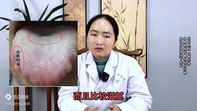 脾虚，吃归脾丸越补越虚？中医：病根全在舌头上，先化痰再健脾
