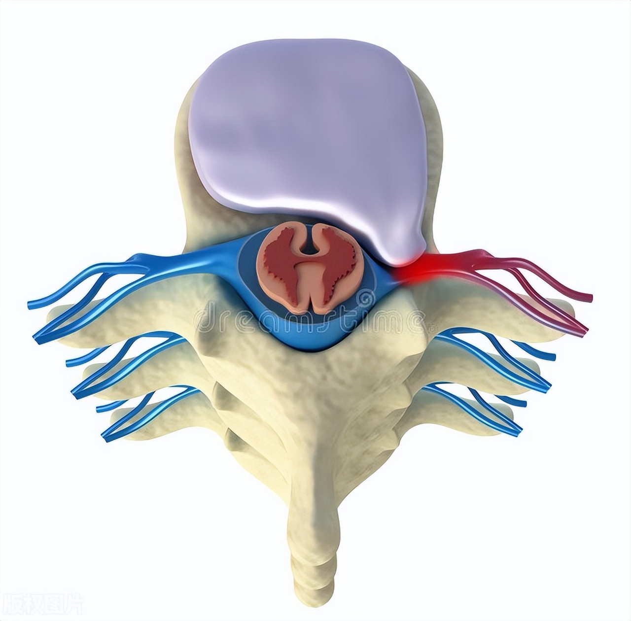 报告显示腰5椎体Ⅰ度滑脱，怎么办？