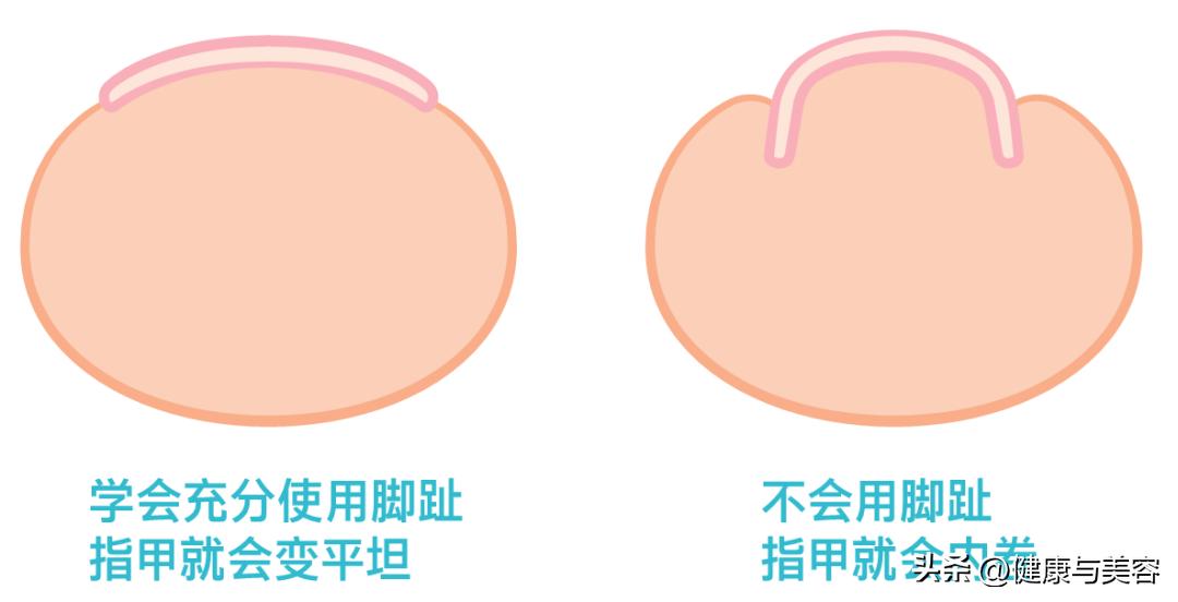 指甲卷曲内卷,指甲卷曲用什么药