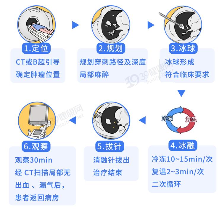 一针抗癌药可治哪几种癌,治愈恶性肿瘤癌症的真正手段