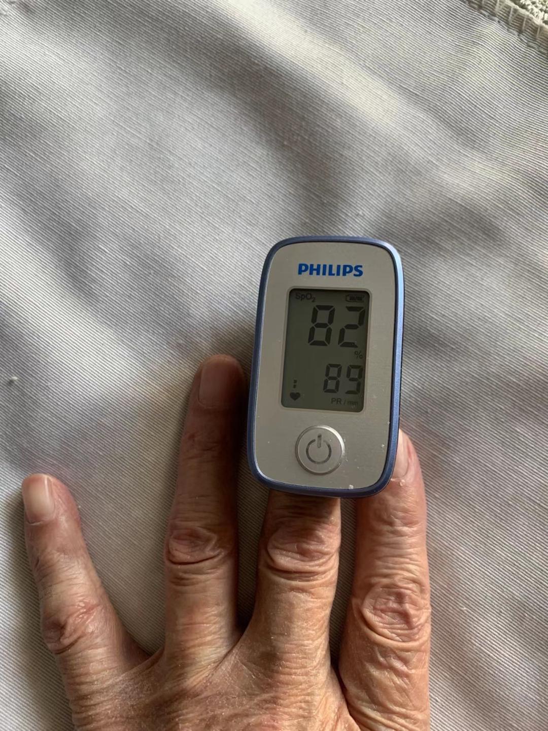 鱼跃医疗血氧仪涨价事件评价,血氧仪涨价断货