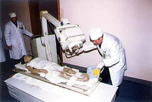 尸毒的危害解谜,辛追女尸为什么那么恐怖