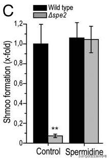 备孕强精的误区你中了几个,亚精胺对生成精子有用吗