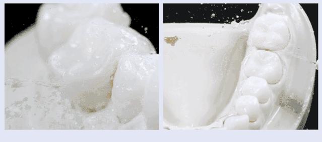 电动冲牙器便携式深层清洁牙齿,牙刷电动软毛护牙