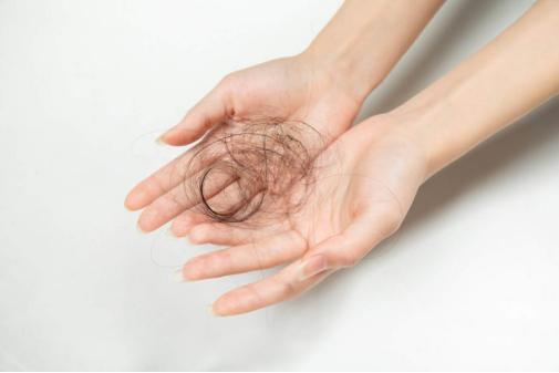 脱发严重简单有效治脱发的方法,严重脱发有什么方法可以治