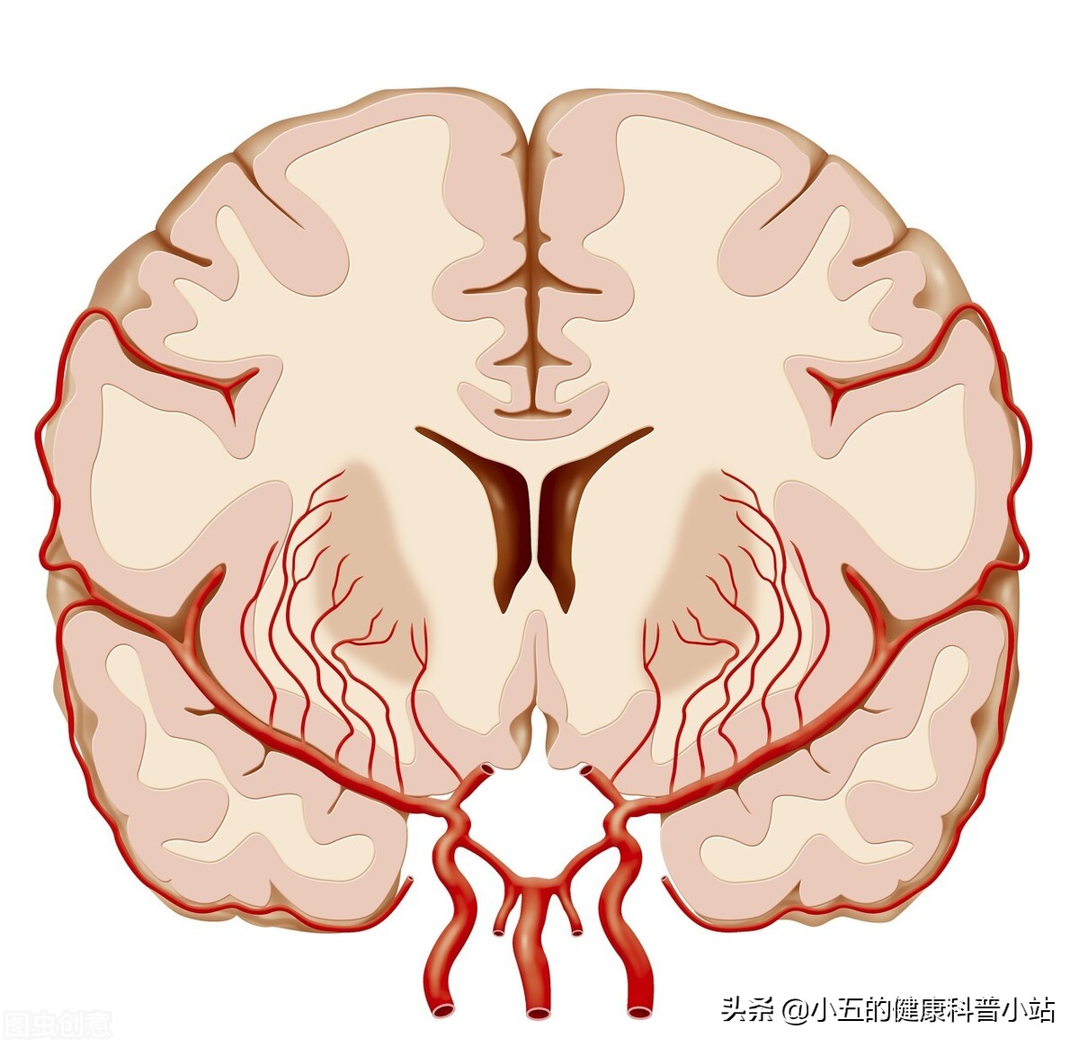 老年人暂时性脑供血不足怎么办,老人怎样改善大脑供血不足