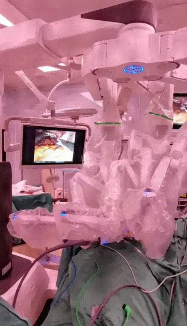 科技点亮生命之光机器人助力山西白求恩医院妇科手术飞跃