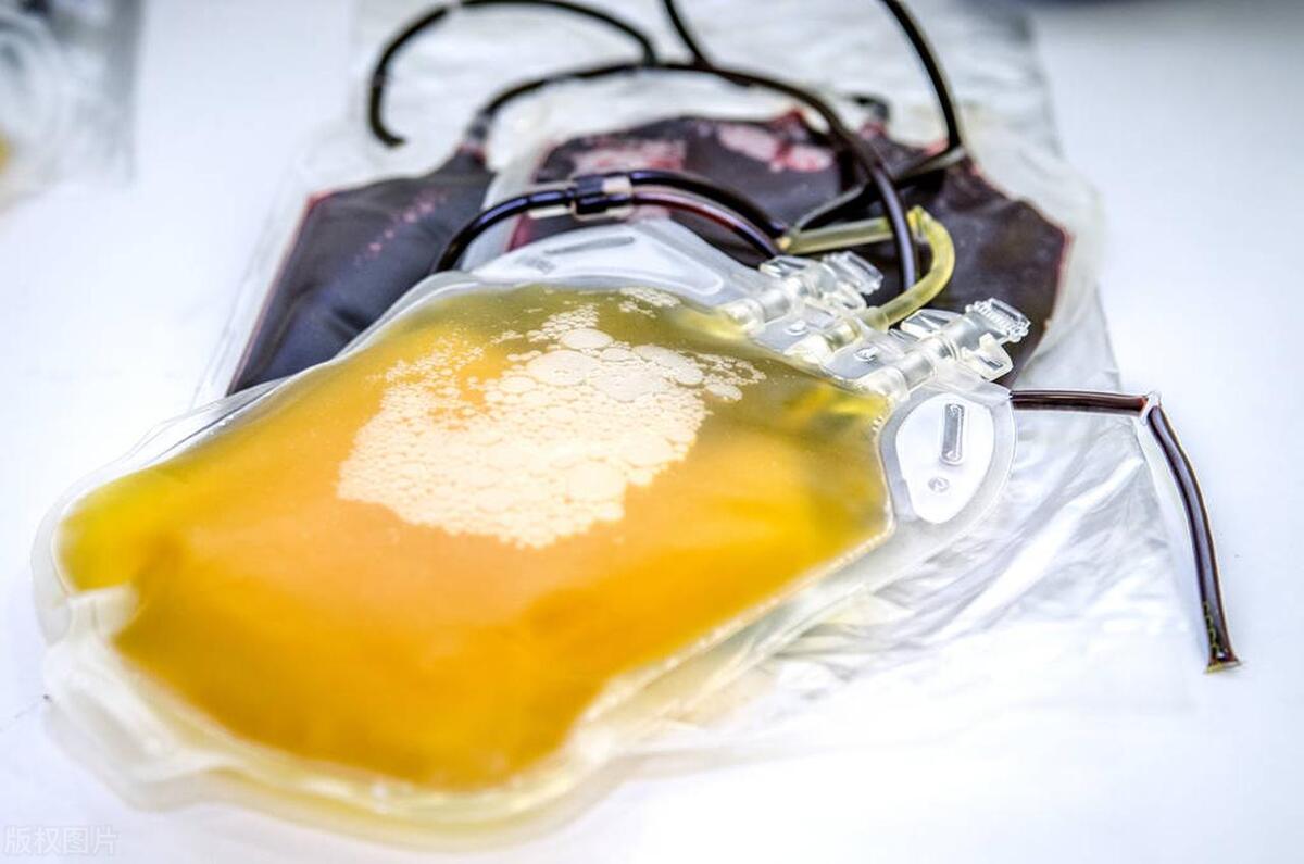 急性脑梗死的最佳治疗方案,急性脑梗死的治疗方案是什么