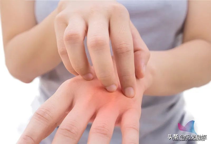 冬天遇热浑身瘙痒是什么原因,冬天浑身干燥瘙痒是怎么回事