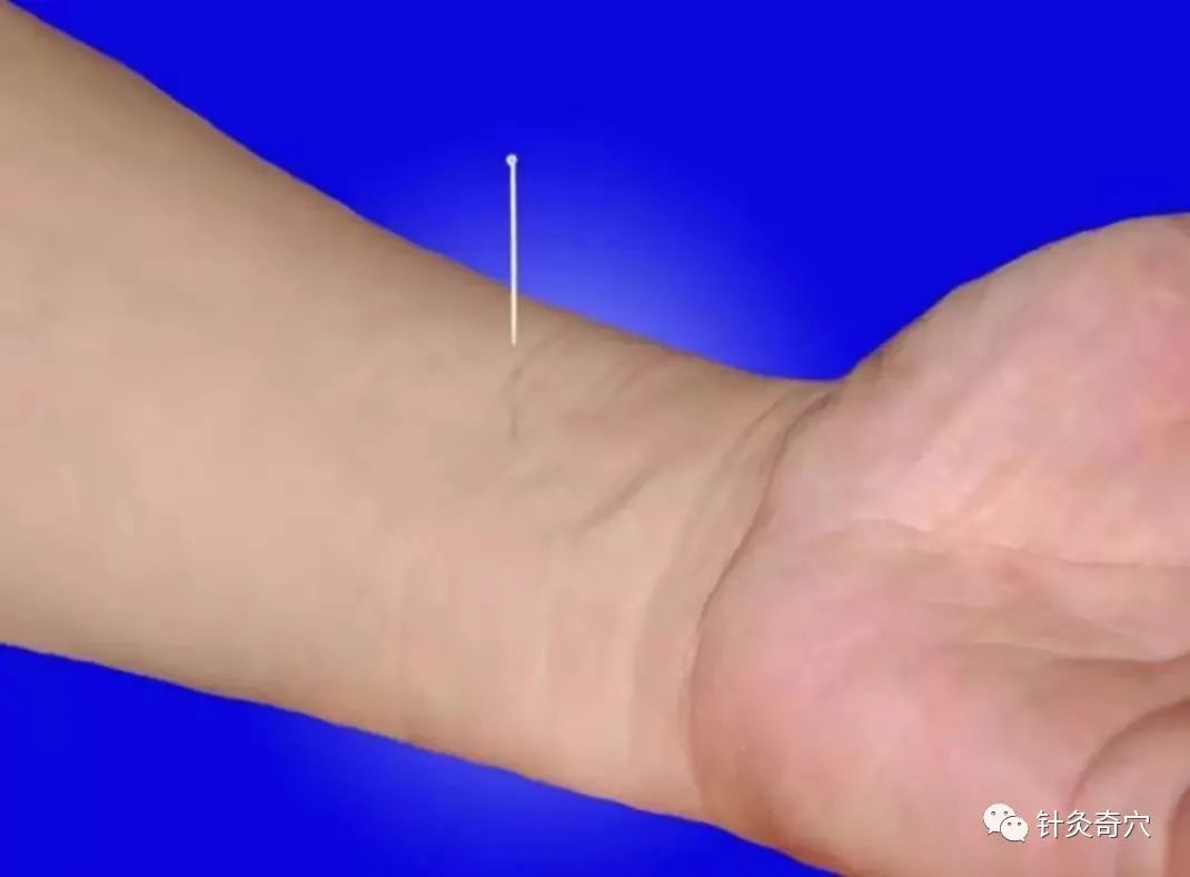 史上最全中医针灸视频教程全集,针灸治疗真实图片大全