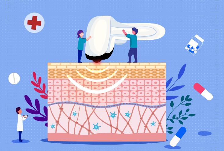 光子嫩肤为啥爆痘,光子嫩肤一年做几次