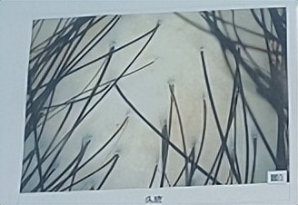 当代秃头青年的脱发自救精品指南,脱发快秃头了怎么办