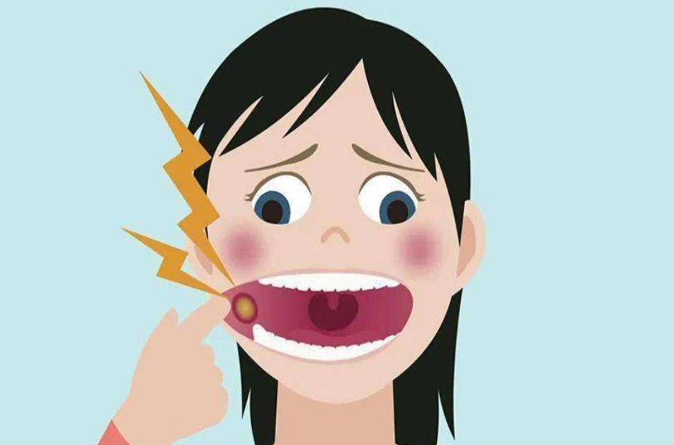 口腔溃疡吃维生素b1b2b12维生素c,有种痛叫口腔溃疡