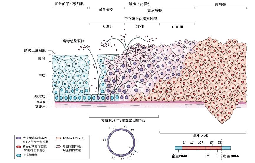 宫颈癌前病变抗病毒药物,三联生物肿瘤标志物