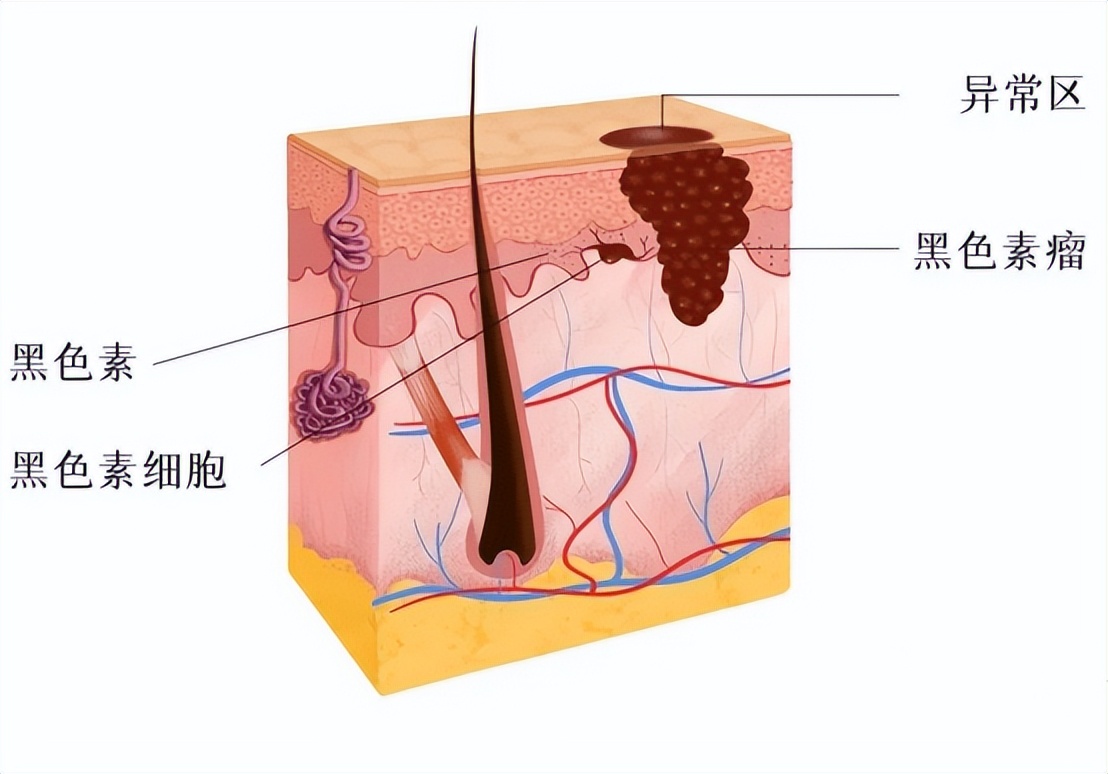 胸腔镜下胸膜冷冻活检，在胸腔积液诊断中，有价值和安全性么