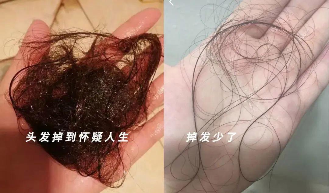 头顶一片光秃秃？过来人教你3招让发量翻倍！抓紧时间做起来！