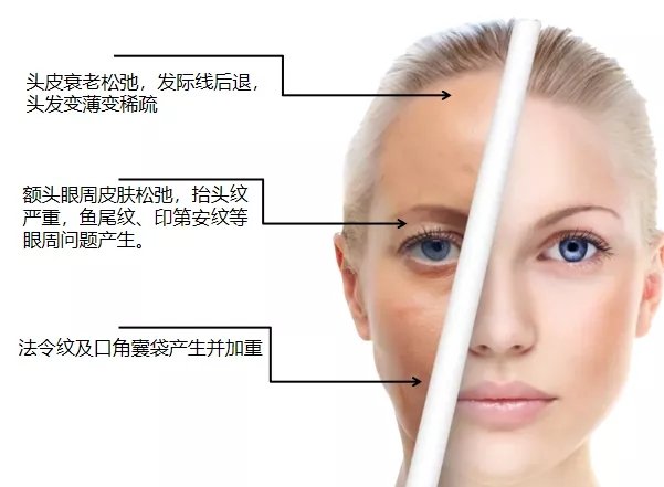 别人脱单你脱发,年轻人脱单脱发