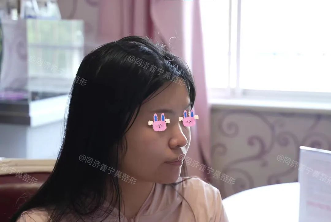 怎样让鼻子变立体精致,鼻子立体小技巧