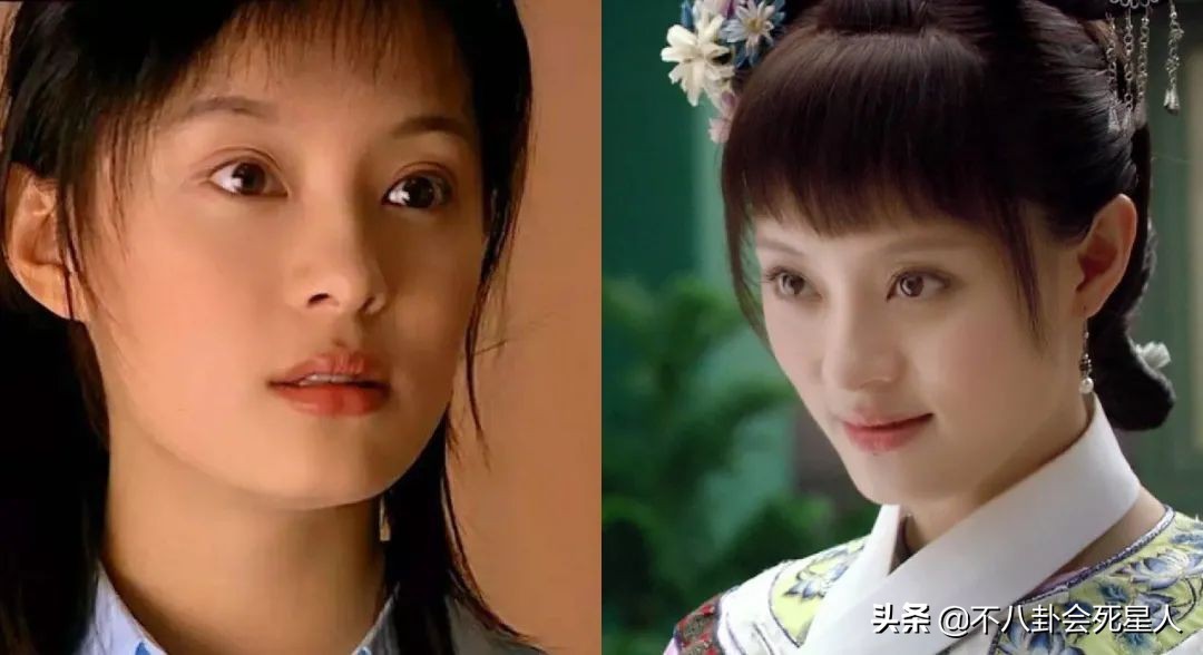 景甜悲伤蛙双眼皮照片,明星割双眼皮前后对比图