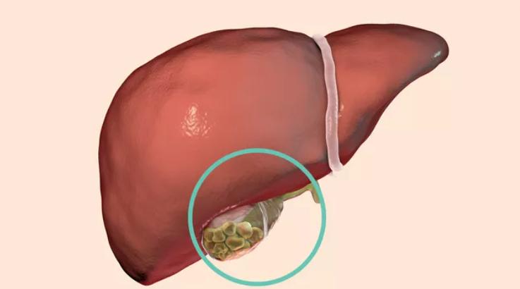 肚子疼的原因以及缓解方法,引起肚子疼的原因有哪些