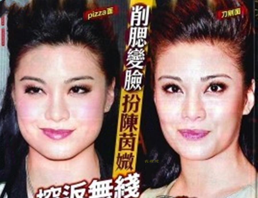 明星改善v型脸,为什么现在的女明星都是v型脸