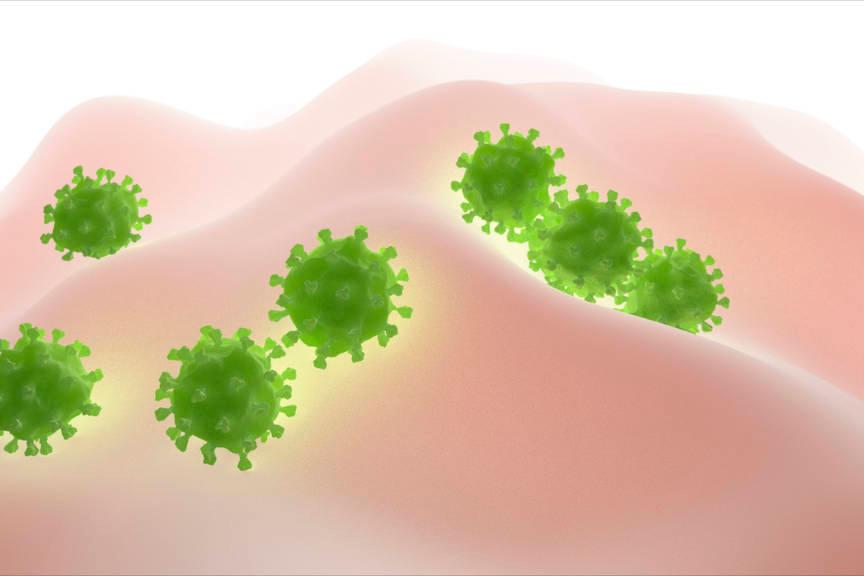 头皮毛囊炎饮食要注意什么,头皮毛囊炎反复发作用药