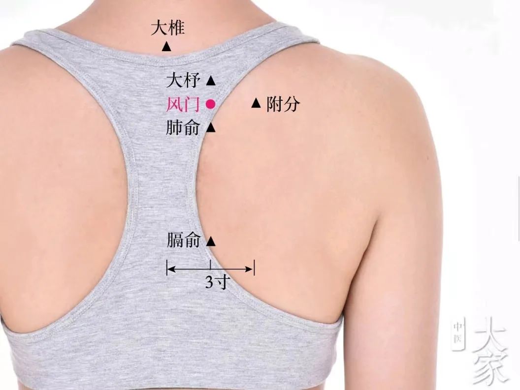 外感风寒拔罐治疗穴位,中医针灸放血治疗感冒