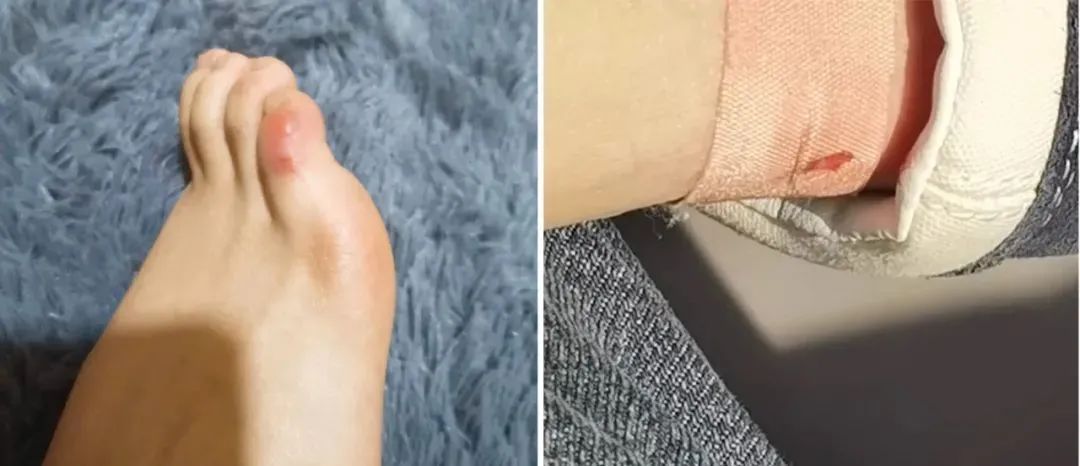 帆布鞋穿搭显瘦,时尚帆布鞋休闲百搭时髦又减龄