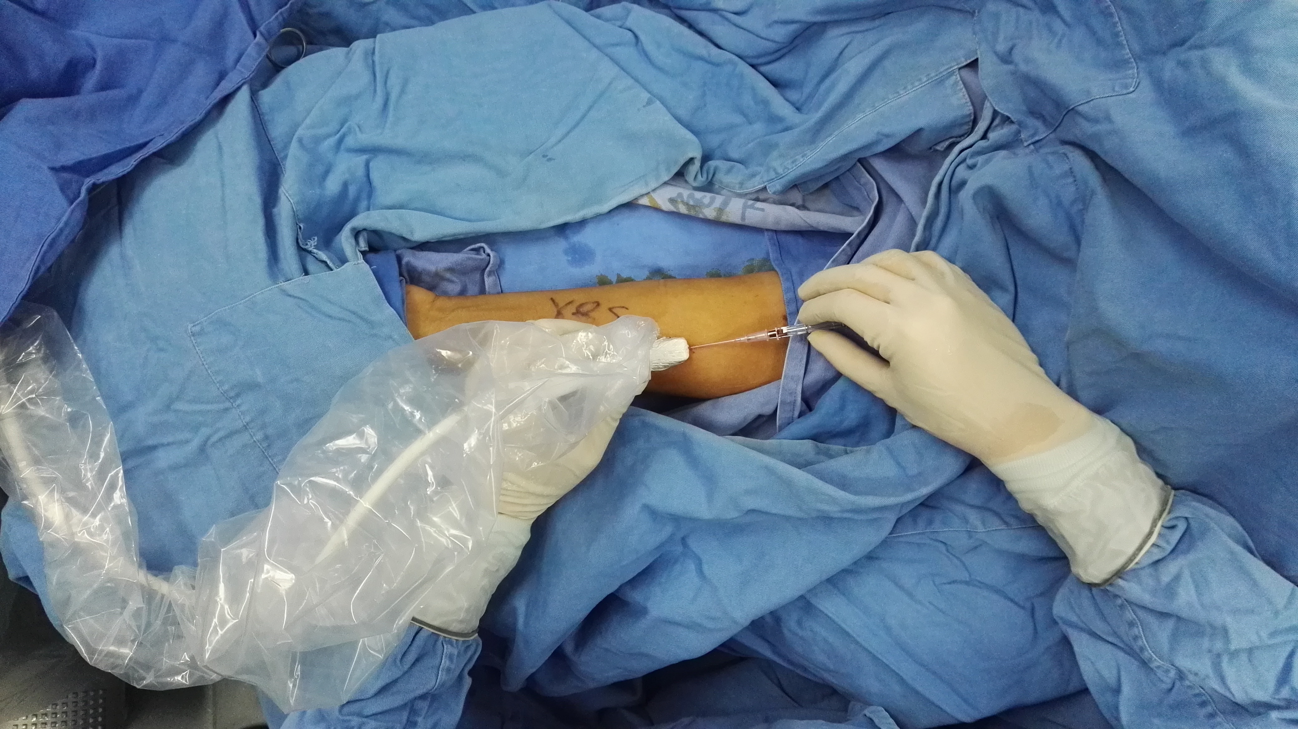 谷丙转氨酶高多少可以判定为肝癌,谷丙转氨酶偏高多少才是肝癌