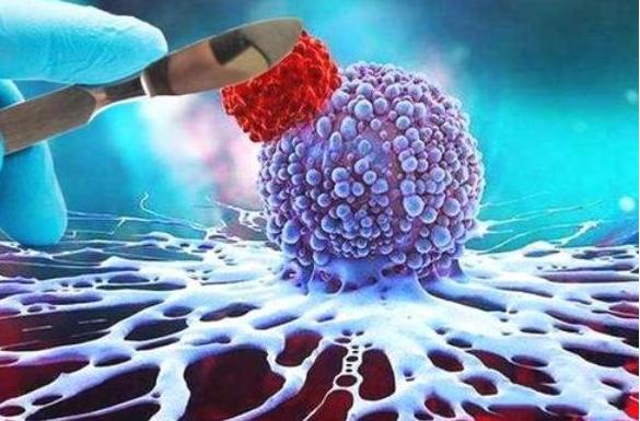 中国食品对癌症有多少影响,专家说食品添加剂与癌症没关系