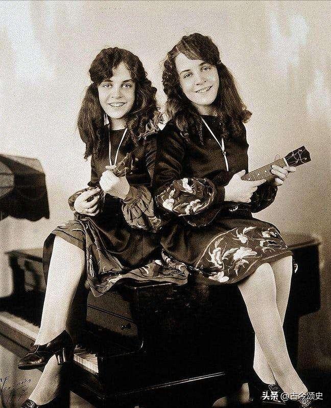 连体人结婚生子,连体人如何生子