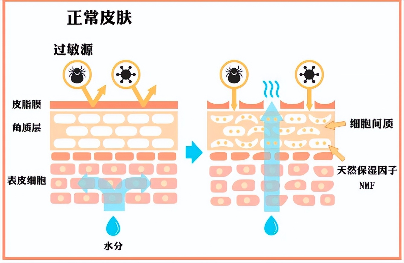 换季肌肤急救小妙招,冬季肌肤护理小技巧