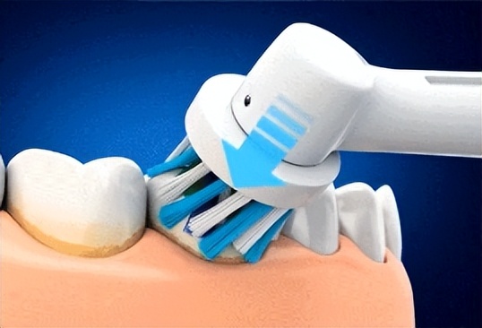 usmile和飞利浦电动牙刷测评,买电动牙刷好还是冲牙器好