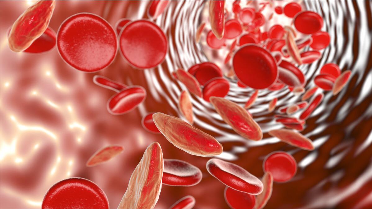 不要错把癌症当小毛病，身体出现2种情况，或是子宫内膜癌的信号