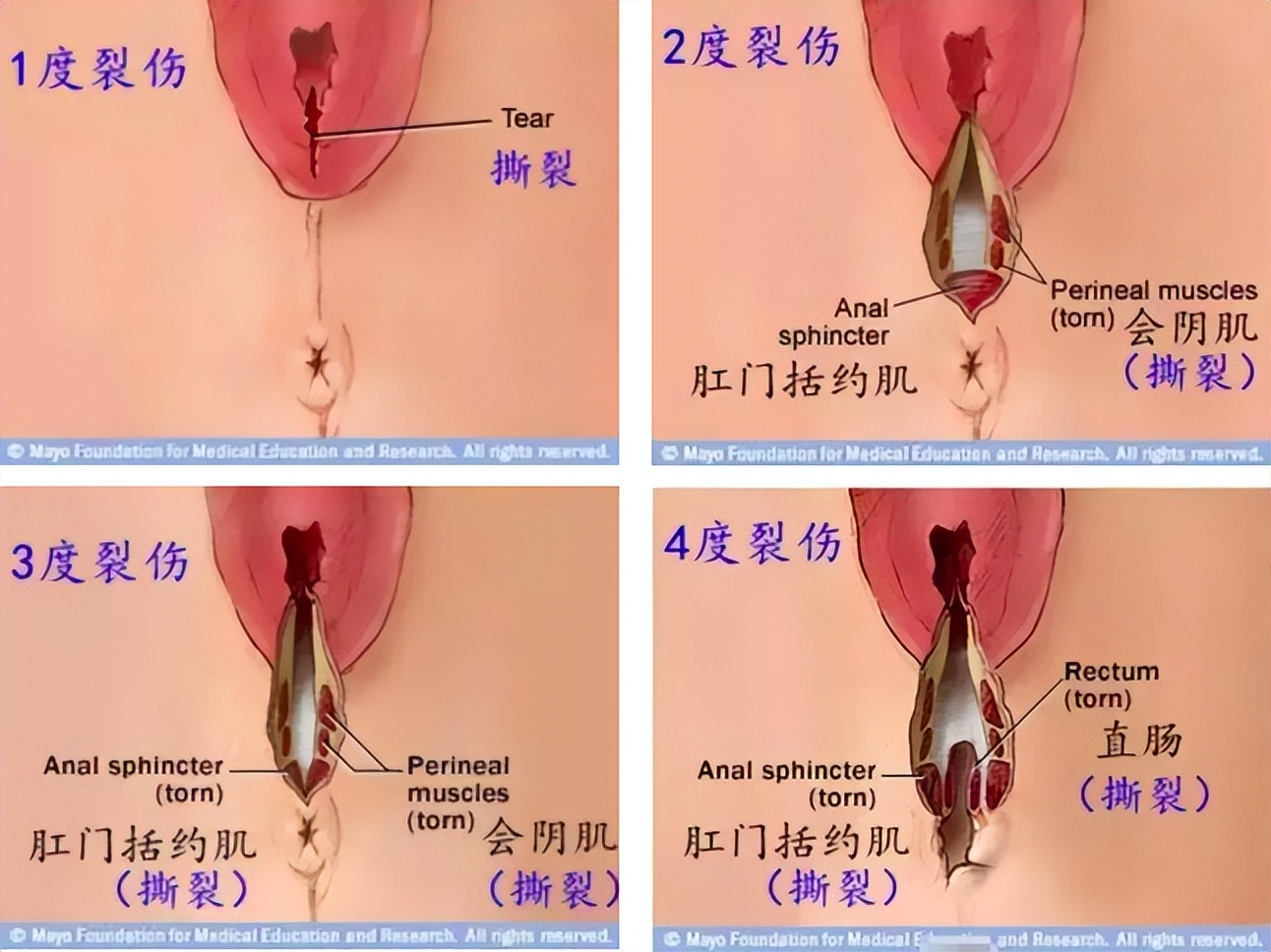 西安大兴医院分娩,西安大兴区医院顺产