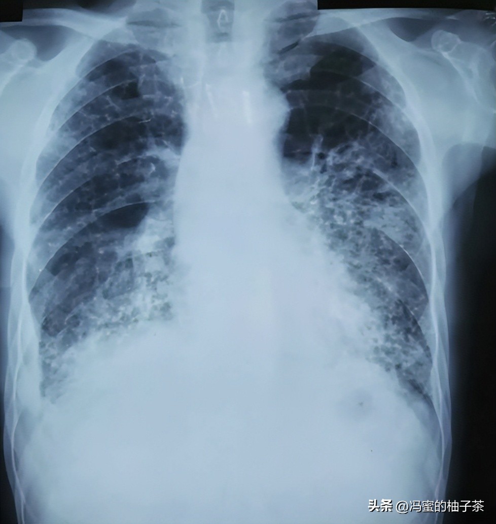 2009年湖南女子生下重2斤小猴子,湖南女子生了个小猴子上综艺节目