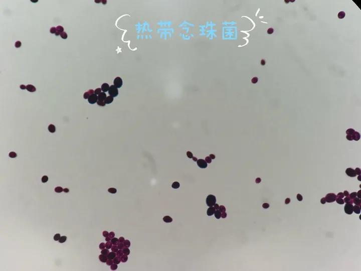 经常穿紧身内裤的坏处,经常穿紧身裤子对身体有影响吗