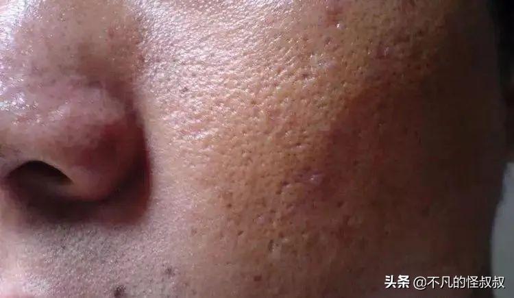 护肤搓泥皮肤粗糙怎么办,护肤搓泥用什么